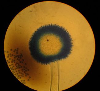 Aspergillus Fruchtstand1